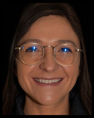 Patient smile before treatment at English Dental