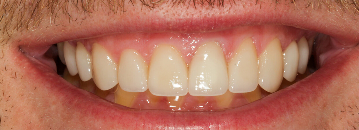 Cosmetic dentistry consultation at English Dental in Louisville